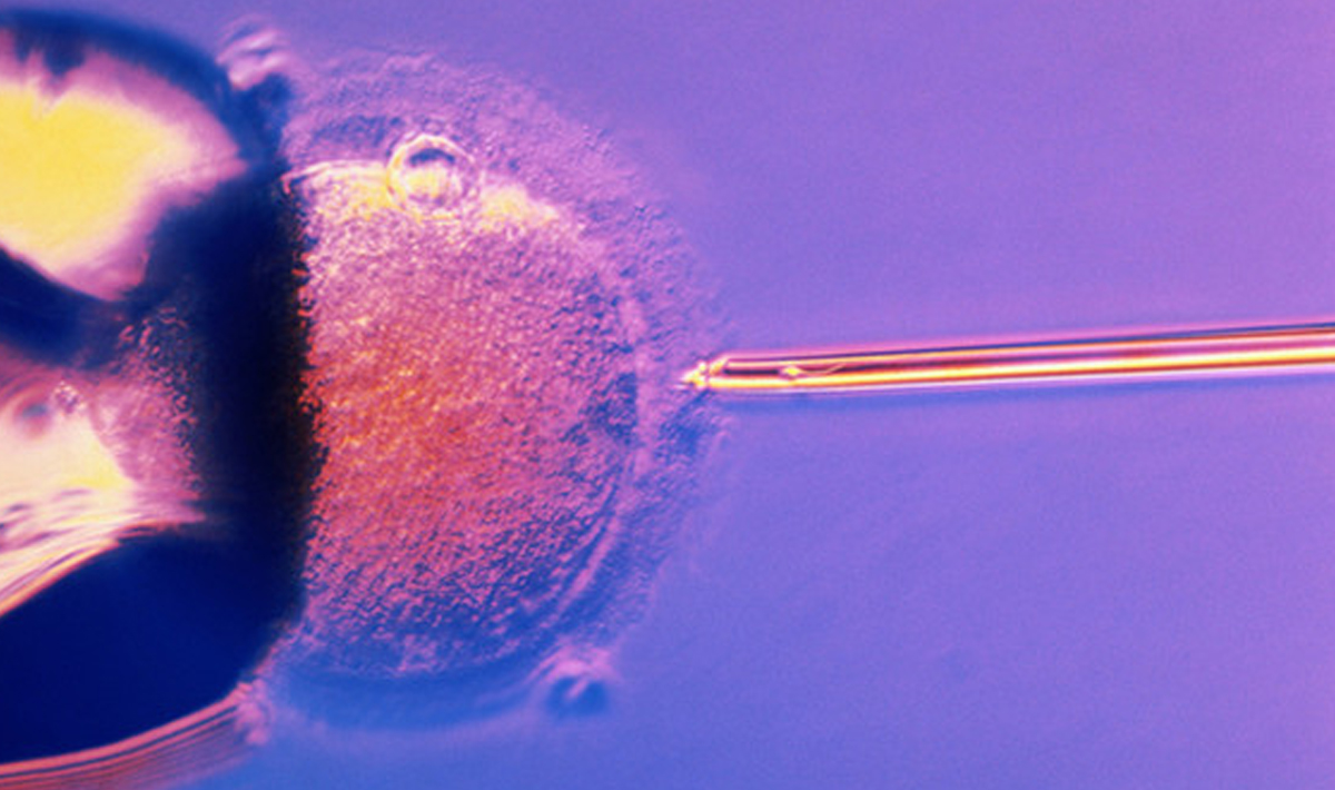 Al momento stai visualizzando Fecondazione in vitro e rischio tumore mammario: dati rassicuranti